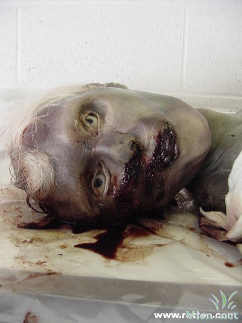 组图慎入传说中英国出土的真实吸血鬼2